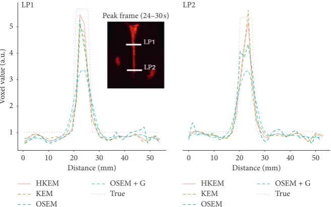Figure 4: A comparison between the true line proﬁles, LP1 and LP2, and the ones obtained from the reconstructed image with OSEM,OSEM+G, KEM, and HKEM.