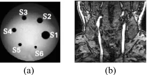 Fig. 2.Slices of the MR images used to estimate the kernel matrix for the(a) phantom and (b) patient studies.