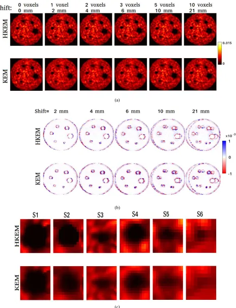 Fig. 9.Reconstructed phantom images with KEM using only MR and HKEM on 5-s acquisition