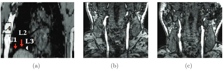 Figure 1. Slices of the MR images used to estimate the kernel matrix for (a) simulated anthropomorphic torso, (b) [18F]FDG and (c) [18F]NaF studies.