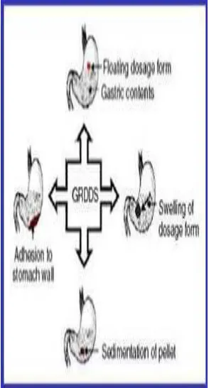 Fig 5: Gastro retentive approaches 