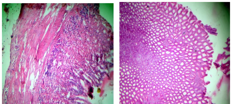 Fig:1 Stomach of normal rat                                 Fig:2 Stomach of control rat showing erosion in                                                                                  the upper part of epithelium with RBCs in                                                                                 Eroded portion    