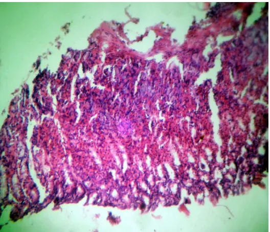 Fig: 5 Stomachs of AEPD treated rats showing small superficial erosion with minimum deviation 
