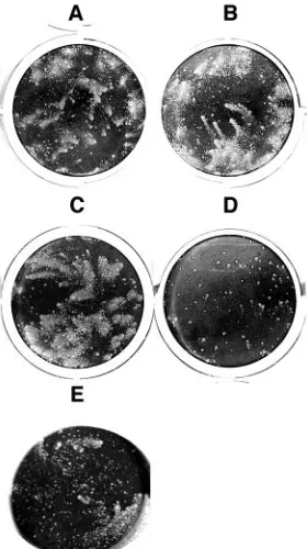 FIG. 4. Inhibition of comet formation by anti-B5R(275t) MAbs.BSC-1 cell monolayers were infected with vaccinia virus strain IHDJ.