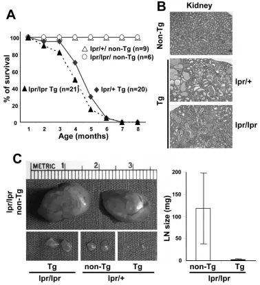 FIG. 5. CD4C/HIV Tg mice deﬁcient for Fas develop an AIDS like disease. (A) Survival curve of homozygous lpr/lpr (nhistology of non-Tg and lpr/lpr or lpr/sclerosis) in 3- to 6-month-old lpr/lpr and lpr/reduced in lpr/lpr Tg mice