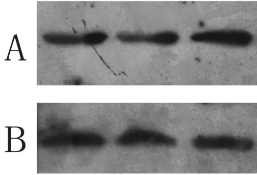 Figure 2.  Standard curves for Tricine-SDS gels with different composition. 10%T, 3%C (▲), R2=0.97; 18%T, 3%C (■), R2=0.953; 18%T, 6%C (●), R2=0.956; 18%T, 6%C plus 4M urea (◆), R2=0.963