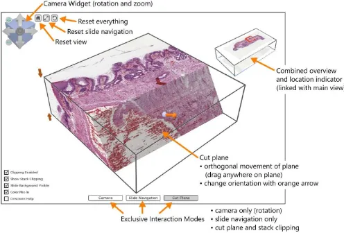 Fig. 2. Slide stack of a colorectal adenocarcinoma consisting of 50 slide images scanned at 20x