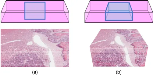 Fig. 5. Revealing the spinal column of the mouse embryo dataset bycropping the slide stack (a) and using a custom clip plane (b).