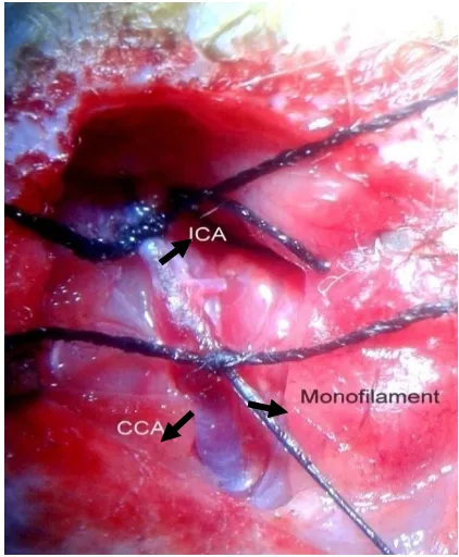 Figure.4: Branches of common carotid artery (CCA)