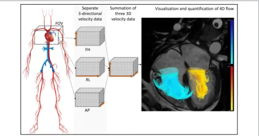 FIGURE 1 | For whole heart 4D ﬂow acquisition, the ﬁeld of view is planned to cover all chambers of the heart
