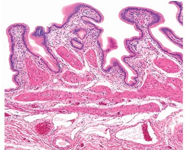 FIG 4  – showing normal histology of GB, mucosa thrown into folds, lamina 