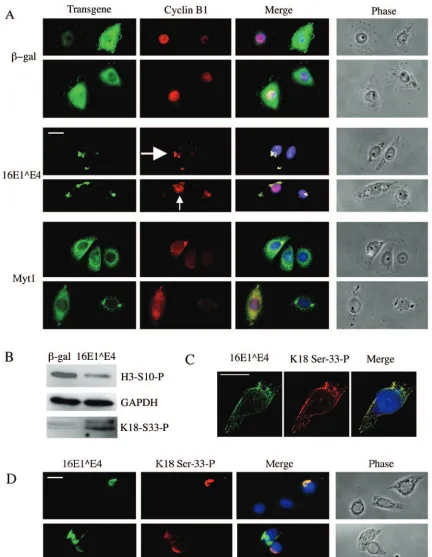 FIG. 5. 16E1∧sidase, 16E1indicates a cell with predominantly cytoplasmic cyclin B1, and the small white arrow indicates a cell in which some of the cyclin B1 has enteredthe nucleus