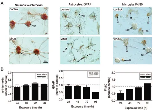 FIG. 1. CNS culture characteristics. (A) Representative microscopic ﬁelds from control and virally infected cultures immunostained withcell-speciﬁc antibodies for neurons, astrocytes, and microglia