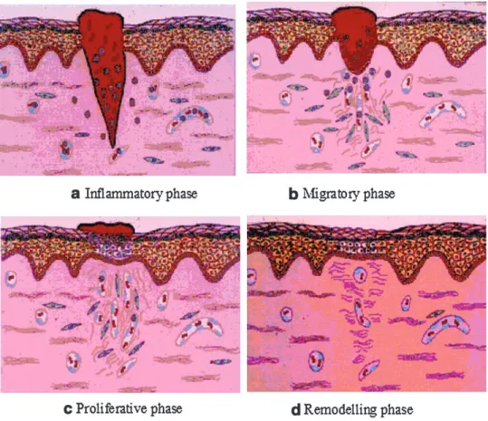 Figure 1. Schematic representation of the phases of wound healing (a) infiltration of neutrophils into the wound area (b) invasion of wound area by epithelial cells (c) epithelium completely covers the wound (d) many of the capillaries and fibroblasts, for