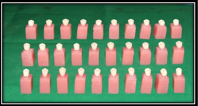 Fig 6:  ALL CERAMIC CROWNS (30 No’s)  