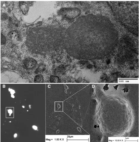 FIG. 6. TEM and SEM analysis of TSG-3�Cell transfected with a 1:1 ratio of YFP-TSG-3(B) Fluorescence image of cellular remains and TSG-3 compartments