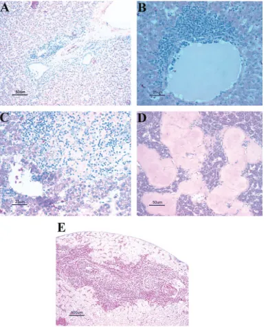 FIG. 3. Microscopic lesions of the liver. (A) Liver section from an oronasally inoculated chicken, showing lymphocytic and scattered hetero-philic portal vein periphlebitis