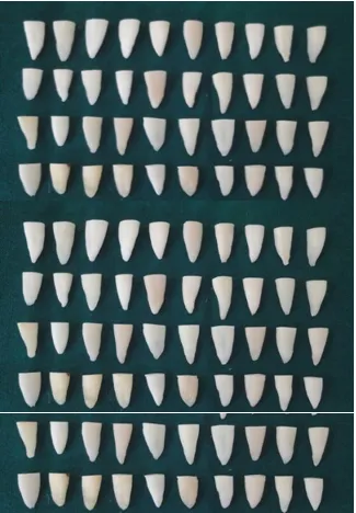 Fig: 1 MANDIBULAR PREMOLARS AFTER DECORONATION AT 