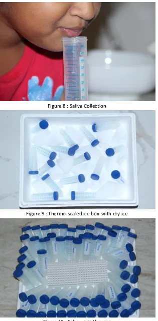 Figure 10 : Saliva vials thawing 