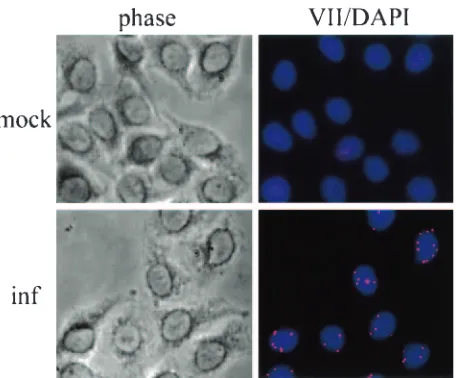 FIG. 6. Protein VII is in nuclear dots in early phase. HeLa cellswere grown on glass coverslips and infected with phenotypically wild-