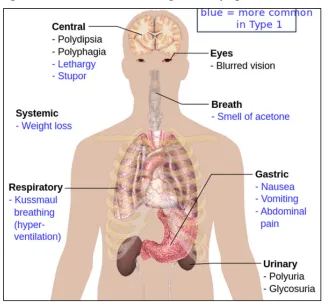 Fig.No.7 : Overview of the most significant symptoms of diabetes. 