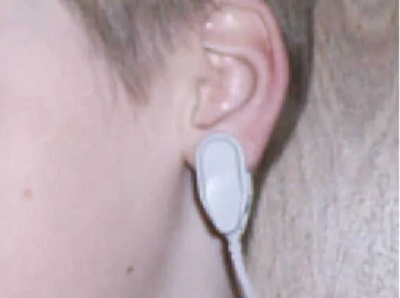 Fig. 3.1. Pulse wave sensor placement 