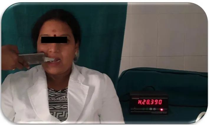 Fig.19 BITE FORCE MEASUREMENT IN DENTULOUS SUBECT-LEFT SIDE