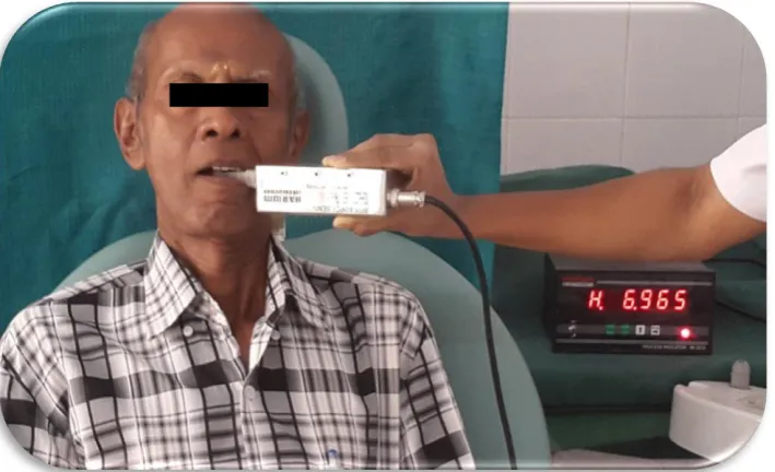 Fig.21 BITE FORCE MEASUREMENT IN EDENTULOUS SUBJECT- RIGHT SIDE                   