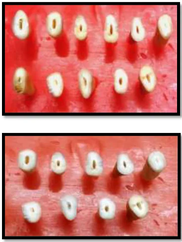 FIGURE 11: DECORONATED TEETH SAMPLES 