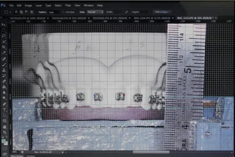 Fig 8: GRID LINE MEASUREMENTS 