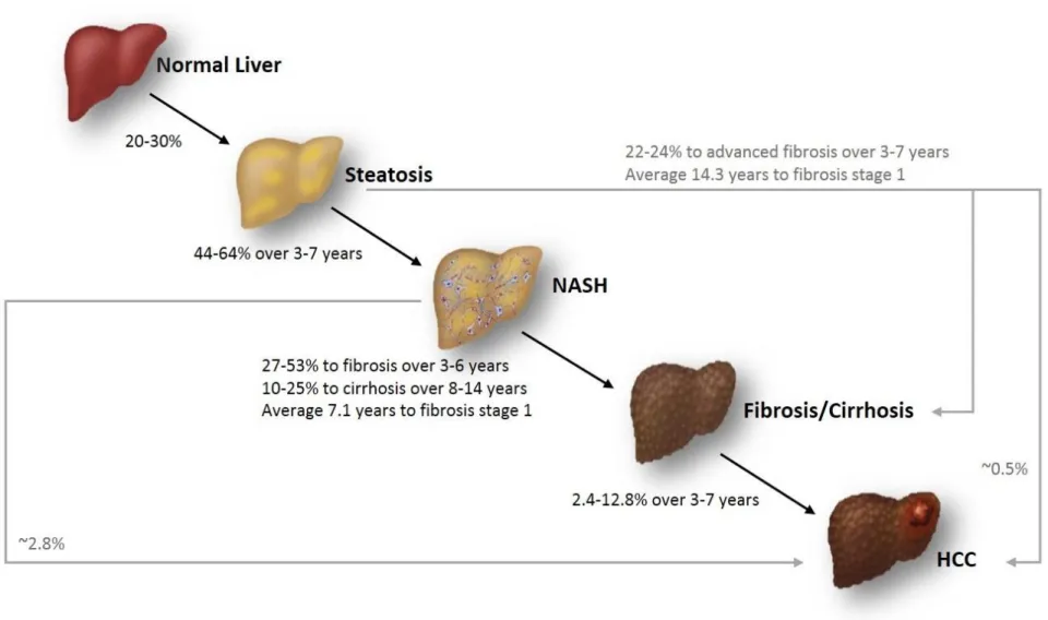 Figure 1.1: Summary of the progression and natural history of NAFLD. Adapted and modified from (Cohen et al., 2011; Goh and McCullough, 2016).