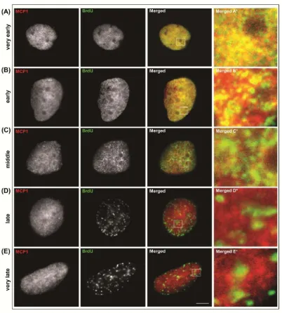 Fig. S2. Immunolocalization of MCP1 (red) and BrdU (green) in human MO59K cells. Classification of cells in S-phase relies on the observation that cells display replication sites as small spots throughout the nucleus (A) at very early S-phase (BrdU pattern