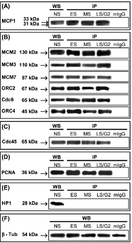 Fig. 1. Immunoprecipitation (IP) of HeLa nuclear extracts at different phases of the cell cycle with anti-MCP1 anti-body