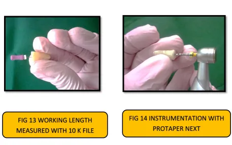 FIG 13 WORKING LENGTH  
