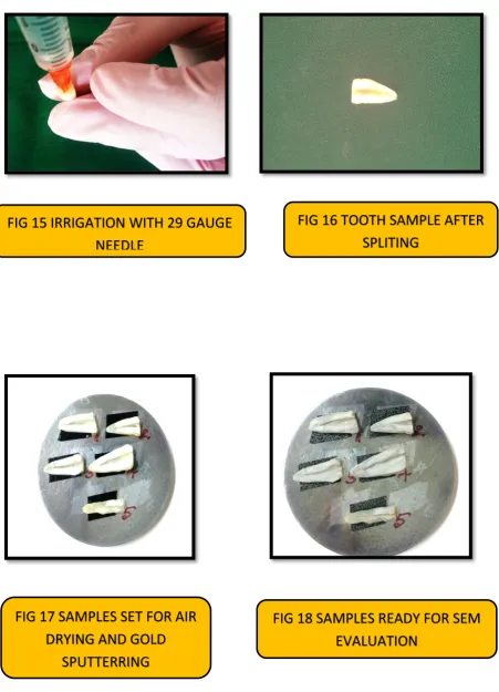 FIG 16 TOOTH SAMPLE AFTER 