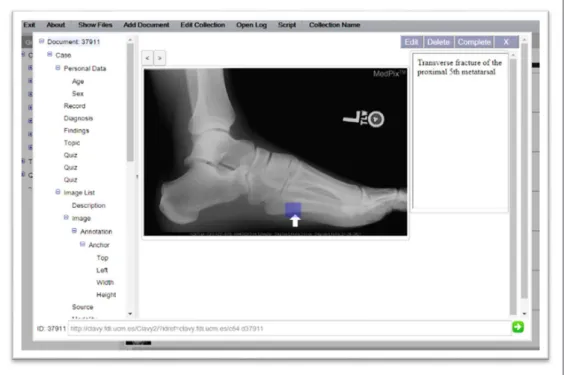 Figure 6 shows a screenshot that displays part of a SCORM object obtained from a MedPix case  represented through a Clavy document