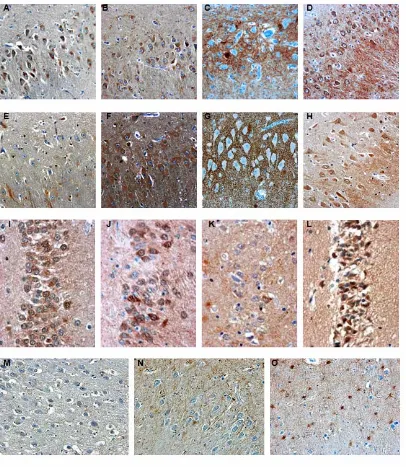Figure 4 Neurotransmitters in hippocampus. Immunohistochemistry illustrated the comparisons of CA3 region 