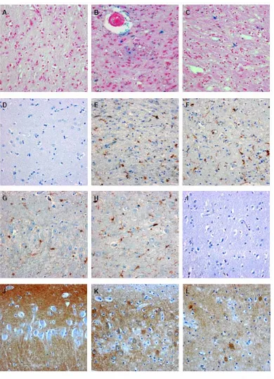 Figure 5 Specific accumulations in striatum and hippocampus. For Perl's Prussian blue stains, iron depositions were 