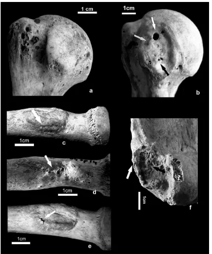 Figure 5. Healthy entheses (a, c) and enthesopathies (b, d–f) on the proximal humerus and radius