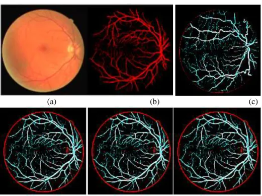 Fig.  4:  (a)  DRIVE  Database  Coloured  Fundus  Image  (b)  DRIVE  Database  Gold  Standard (c) Segmented Vessels Using  pdAPSO and DIMDF (d) Segmented Vessels  Using  pdAPSO  and  DIMNGF  (e)  Segmented  Vessels  Using  pdAPSO  and  DIMDGF  (f) Segmente