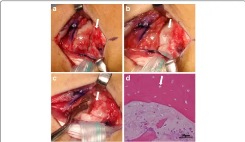 Fig. 2 Intraoperative photographs and microscopic findings of the excised surgical specimen