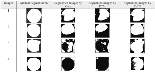 Table 1. Comparison of Segmented Images  Images  Manual Segmentation  Segmented Images by 