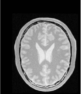 Figure 2. The original image fixedImage.nii (left) and translated image movingImage.nii (right).