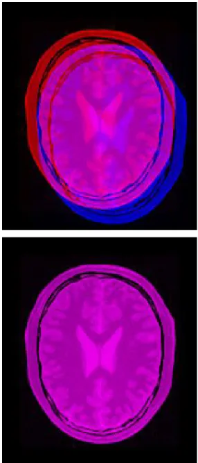 Figure 3. Mean image before registration (left) and mean image after registration (right)