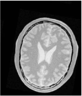 Figure 8. The original image fixedImage.nii (left) and translated and rotated image movingImage.nii (right).