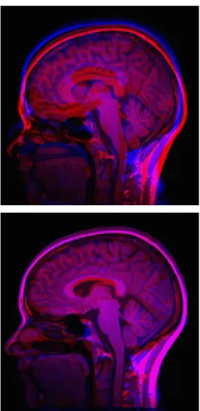 Figure 1. Original mean image of two different subjects (left) and registered mean image (right) using the line of code above