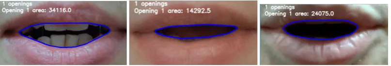 Figure 13where the tongue is protruding as when licking the lips. Traditional approaches would struggle toc shows an example which combines the use of the convex hull and the teeth detection tocapture the inner lip contour well despite difﬁcult lighting co