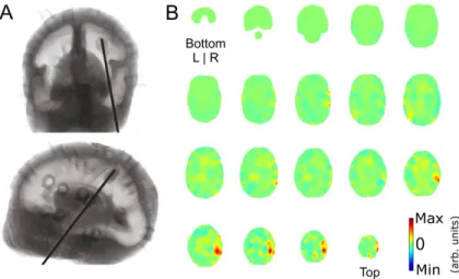 Fig. 6. A) Coronal (top) and sagittal (bottom) x-ray images of the phantom with the target  inserted