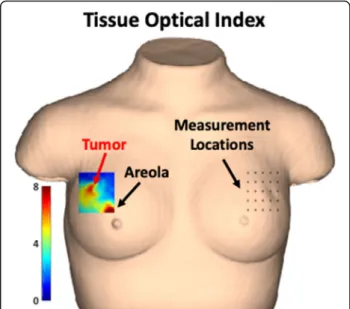 Fig. 1 Bust model of DOSI measurement. Example of DOSI measurement grid locations (right) and subsequent TOI map (left) demonstrating tumor and areolar contrast