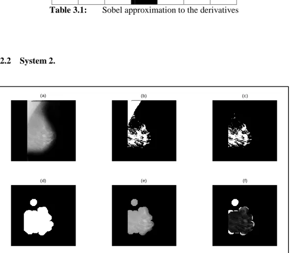 Figure 3.7  Image  Pre-processing  and  Image  Processing.  (a)  original  image,  (b)  BW  image,  (c)  imclearborder  of  image  (b),  (d)  result  after  Morphological  opening  apply on image (c), (e) output image after multiplication between image (a)
